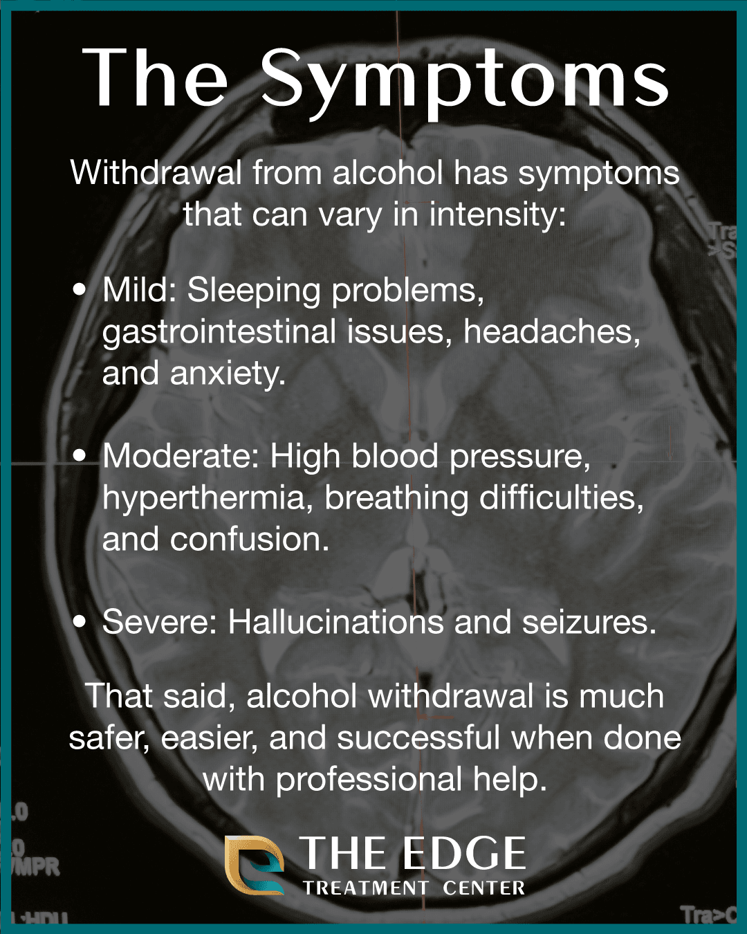 Symptoms of Alcohol Withdrawal